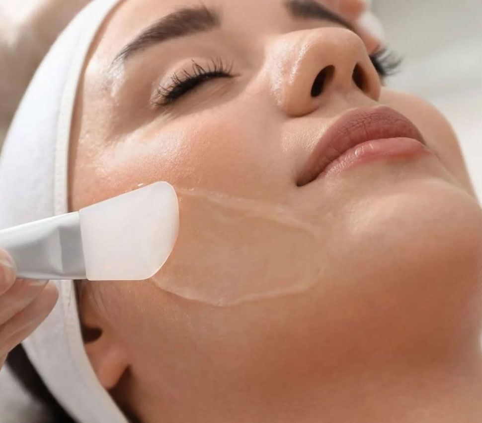 Chemical Peels
